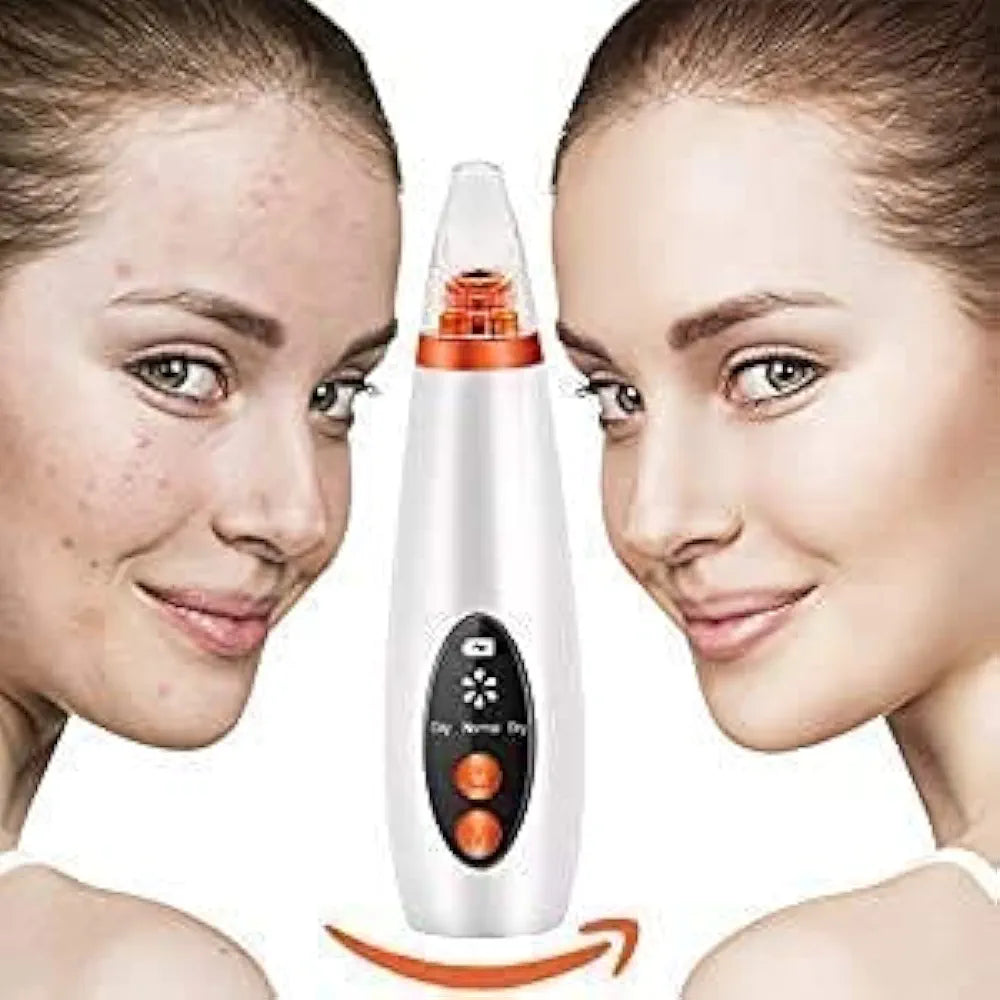 Electric Blackhead Remover | Pore Vacuum Suction Device for Face & Nose | Rechargeable Acne & Whitehead Extractor with 5 Probes