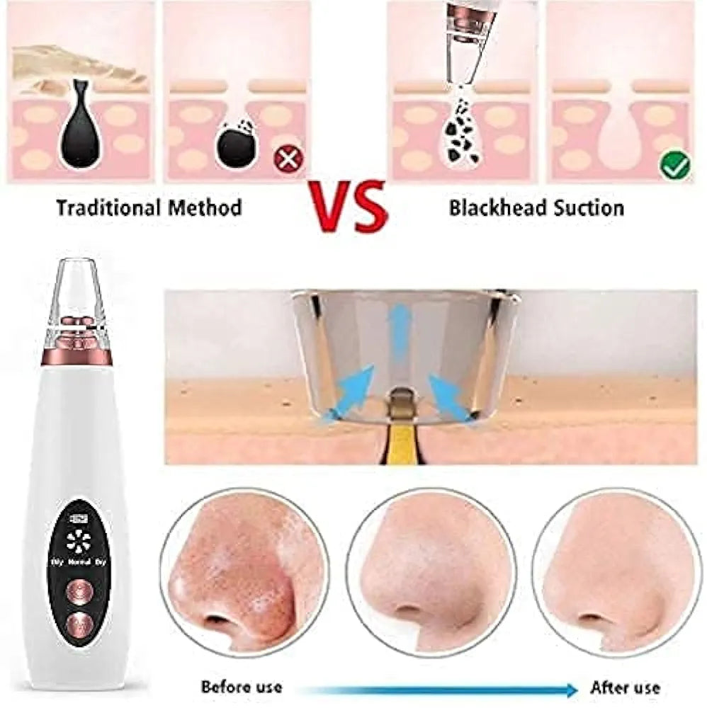 Electric Blackhead Remover | Pore Vacuum Suction Device for Face & Nose | Rechargeable Acne & Whitehead Extractor with 5 Probes